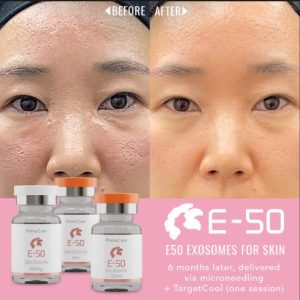 E50 Exosomes